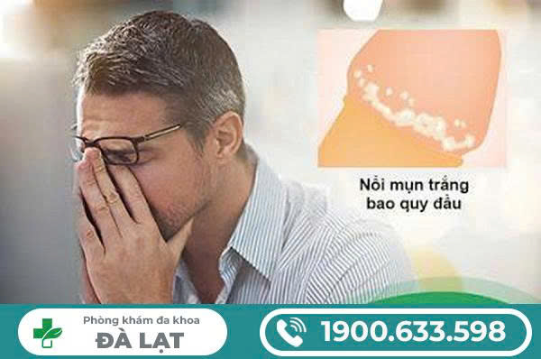 Hình ảnh minh họa